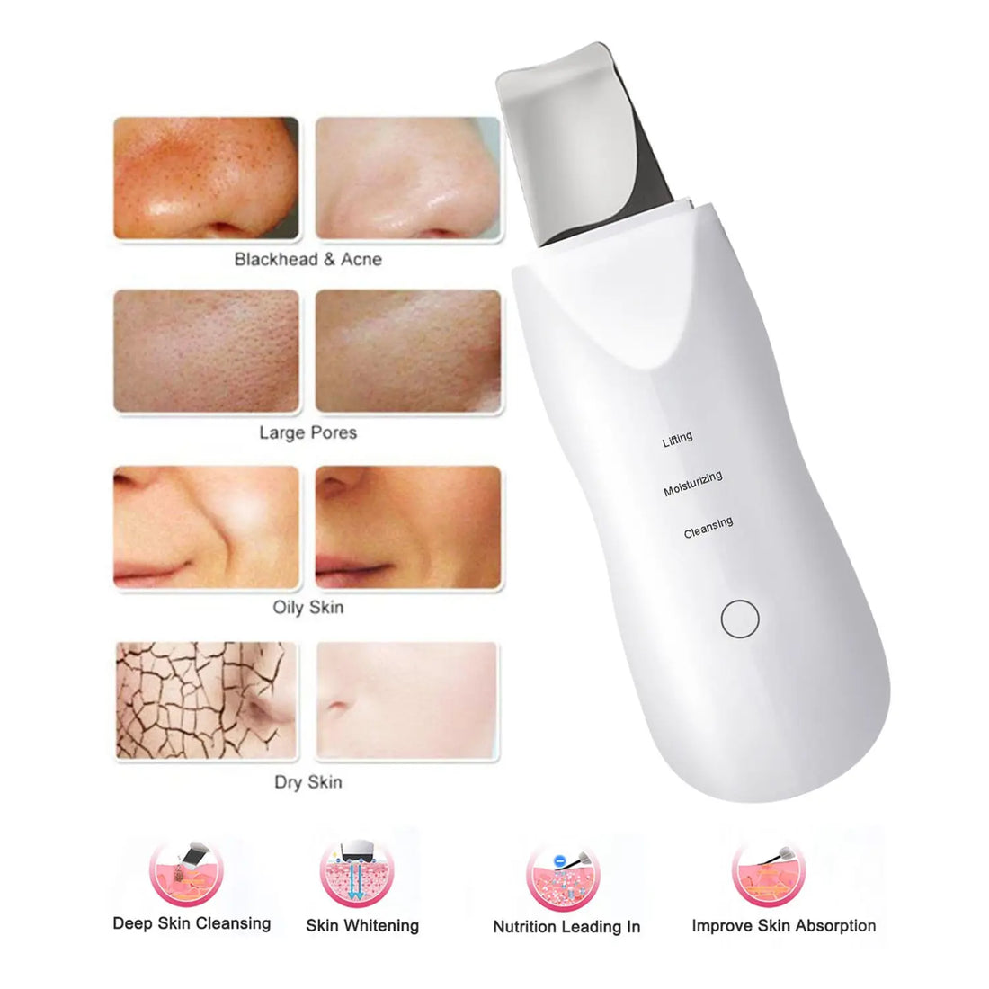 Facial Vibration Massage Scrubber – Ion Acne & Blackhead Remover with Peeling Shovel Cleaner