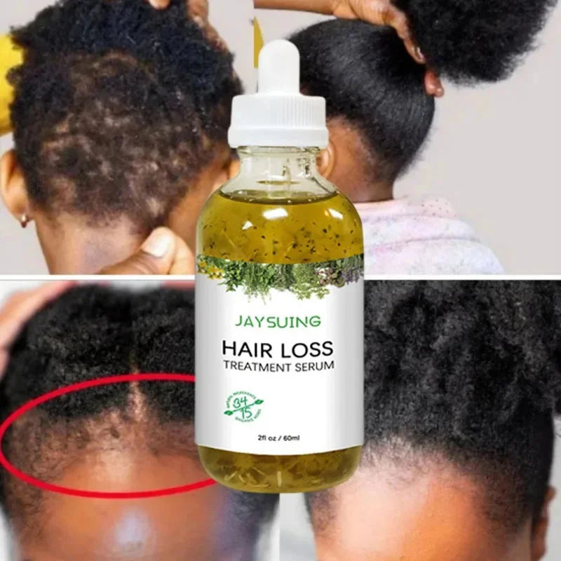 Rosemary Hair Growth Serum | Anti-Hair Loss & Scalp Essential Oil